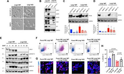 Lrig1 regulates the balance between proliferation and quiescence in glioblastoma stem cells